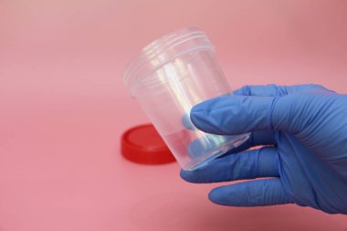 Mavi lateks eldivenli bir el idrar toplamak için bir kap tutar. Analiz için bir doktorun elindeki plastik kap. Analiz kavanozu boş. Pembe arkaplan.