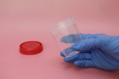 Mavi lateks eldivenli bir el idrar toplamak için bir kap tutar. Analiz için bir doktorun elindeki plastik kap. Analiz kavanozu boş. Pembe arkaplan.