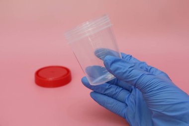 Mavi lateks eldivenli bir el idrar toplamak için bir kap tutar. Analiz için bir doktorun elindeki plastik kap. Analiz kavanozu boş. Pembe arkaplan.