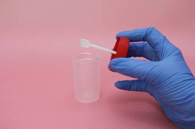Mavi lateks eldivenli bir el dışkı toplamak için bir kap tutar. Doktorun elinde analiz için plastik kap var. Analiz kavanozu boş. Pembe arkaplan.