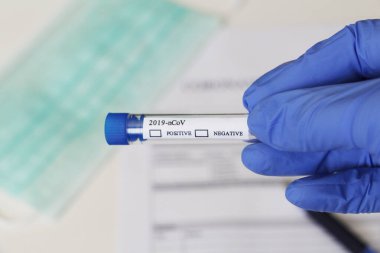 Coronavirus 'un belirlenmesi için laboratuvar testi. Kavram. Hasta analiz için onay formu dolduruyor. Masanın üzerinde testler için rıza yatıyor. Coronavirus laboratuvar testi.