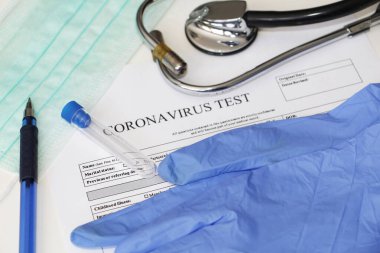 Coronavirus 'un belirlenmesi için laboratuvar testi. Kavram. Analiz için anket. Teste rıza göster. Masanın üzerinde testler için rıza yatıyor. Coronavirus laboratuvar testi.