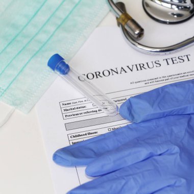 Coronavirus 'un belirlenmesi için laboratuvar testi. Kavram. Analiz için anket. Teste rıza göster. Masanın üzerinde testler için rıza yatıyor. Coronavirus laboratuvar testi.