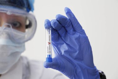 Kavramsal bir fotoğraf koronavirüsü test ediyor: elinde Coronavirus COVID-19 için negatif sonuç veren bir hastanın test tüpü var..