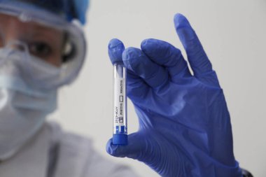 Kavramsal bir fotoğraf koronavirüs testi yapıyor: elinde Coronavirus COVID-19 testi pozitif çıkan bir hastanın test tüpü var..