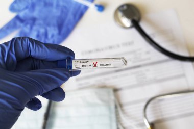 Kavramsal fotoğrafçılık, koronavirüs testi. Elinde hastanın numunesinin olduğu bir test tüpü var. Analizin sonucu olumsuzdur. Tadı Coronavirus COVID-19 için negatif çıktı..
