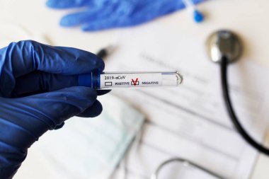 Kavramsal fotoğrafçılık, koronavirüs testi. Elinde hastanın numunesinin olduğu bir test tüpü var. Analizin sonucu olumsuzdur. Tadı Coronavirus COVID-19 için negatif çıktı..