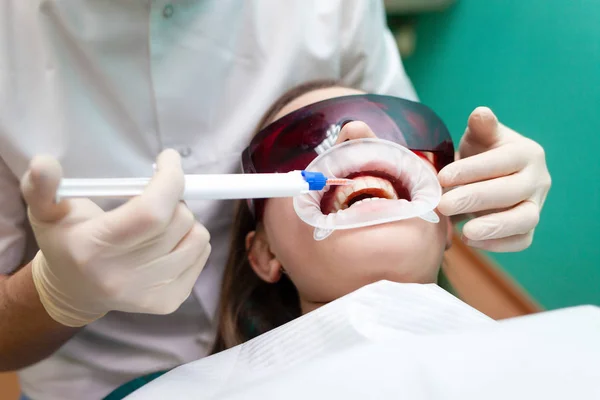 Dentysta Stosuje Żel Wybielania Zębów Pomocą Strzykawki Dziewczyna Przechodzi Zabieg — Zdjęcie stockowe