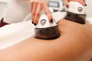 Kozmetik uzmanı müşteriler için kalça vakum masajı prosedürü uyguluyor. Doktor endomasyon cihazı kullanıyor.