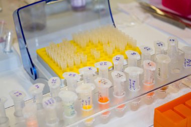 Laboratuarda örnekleri