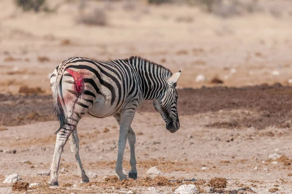 Burchells zebras with visible wound, probably from a lion attack — Stock Photo, Image