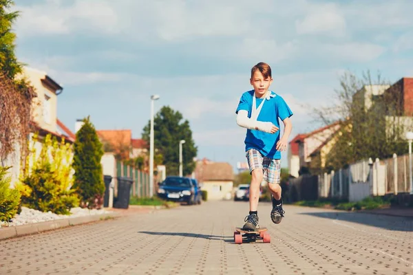 Jongen met gebroken hand — Stockfoto