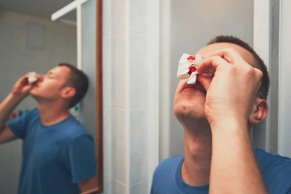 Man with nose bleed — Stock Photo, Image