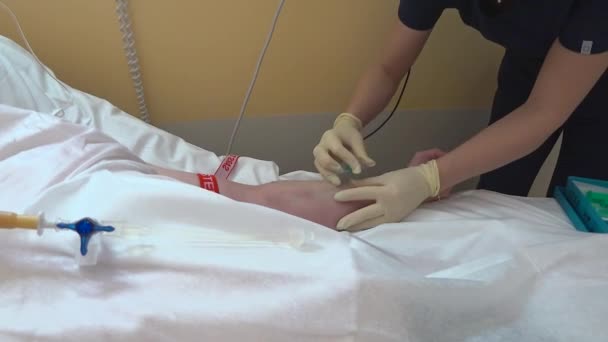 Una Enfermera Enmascarada Identificada Inserta Catéter Vena Del Paciente Detalles — Vídeo de stock