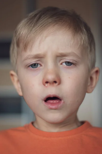 Pięcioletni Chłopiec Alergią Katar Oszklone Oczy — Zdjęcie stockowe
