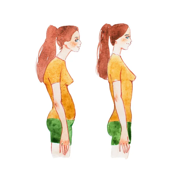 右と間違った姿勢で人の水彩イラスト。通常の健康な背骨と比較で異常の病気脊椎の女性. — ストック写真