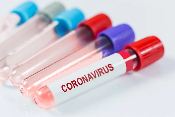 Pruebas de muestras de Coronavirus en laboratorio — Foto de Stock
