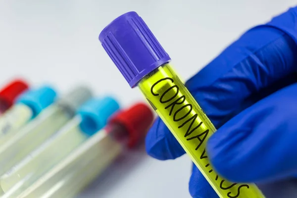 Тестирование коронавируса в лаборатории — стоковое фото