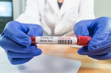 Coronavirus kan örneği tüpünü enfekte etti.