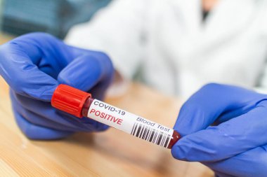 Coronavirus kan örneği tüpünü enfekte etti.