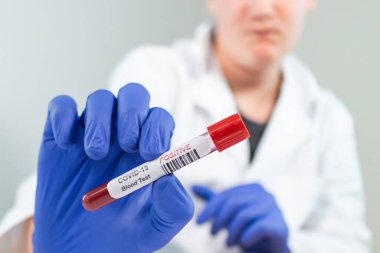 Coronavirus kan örneği tüpünü enfekte etti.