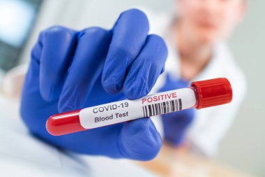 Coronavirus kan örneği tüpünü enfekte etti.