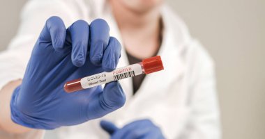 Coronavirus kan örneği tüpünü enfekte etti.