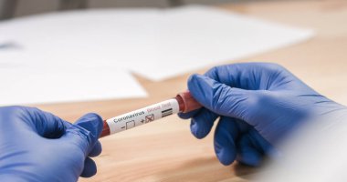 Coronavirus kan örneği tüpünü enfekte etti.