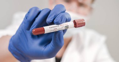Coronavirus kan örneği tüpünü enfekte etti.