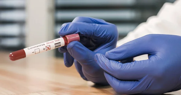 Marcação Coronavirus infectado tubo de amostra de sangue — Fotografia de Stock