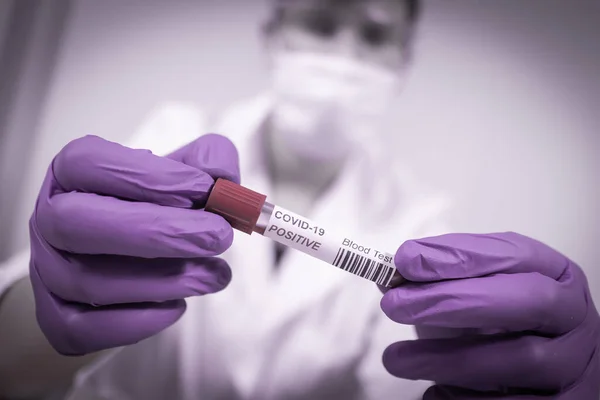 Coronavírus infectado tubo de amostra de sangue — Fotografia de Stock