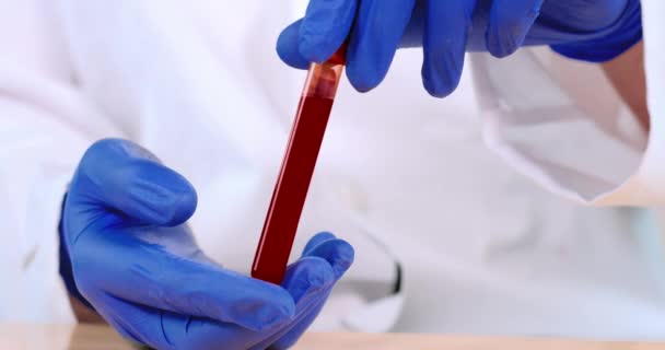 Coronavirus fertőzött vérminta cső — Stock videók