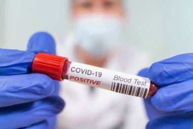 Coronavirus kan örneği tüpünü enfekte etti.