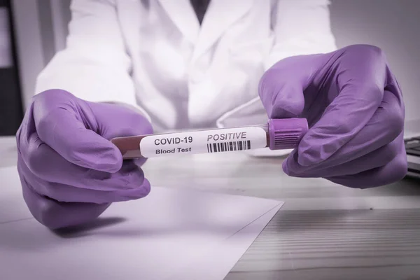 Coronavírus infectado tubo de amostra de sangue — Fotografia de Stock