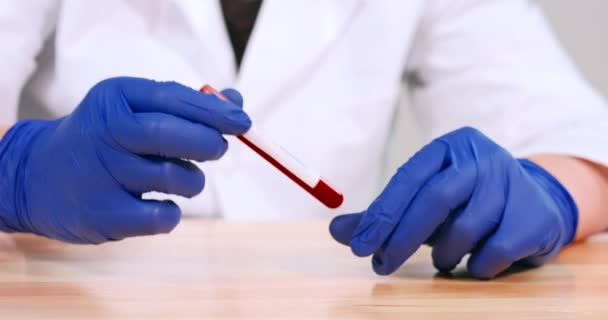 코로나 바이러스에 감염 된 혈액 샘플 튜브 — 비디오