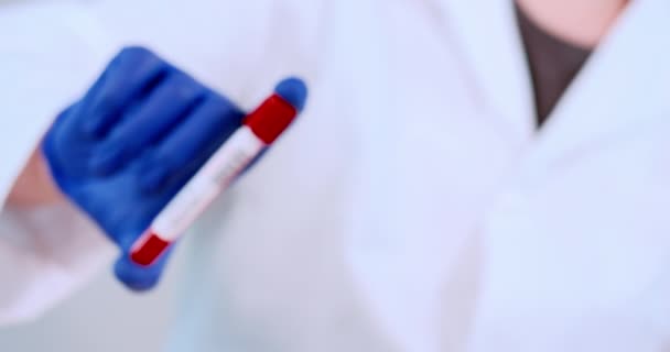 Rurka do pobierania próbek krwi zakażona koronawirusem — Wideo stockowe