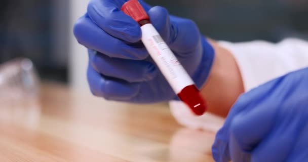 コロナウイルス感染血液サンプルチューブ — ストック動画