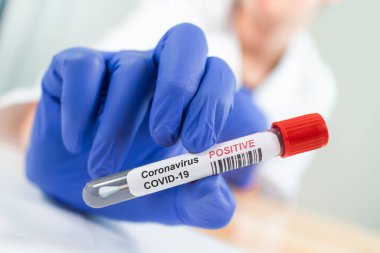 Coronavirus kan örneği tüpünü enfekte etti.