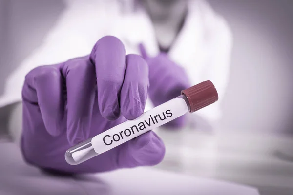 Coronavirus infected swab sample tube — Stock Photo, Image