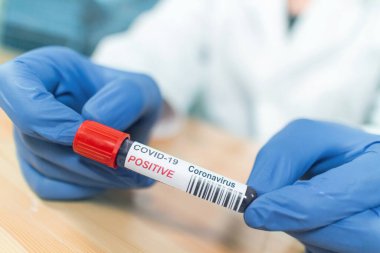 Coronavirus enfekte olmuş örnek testi