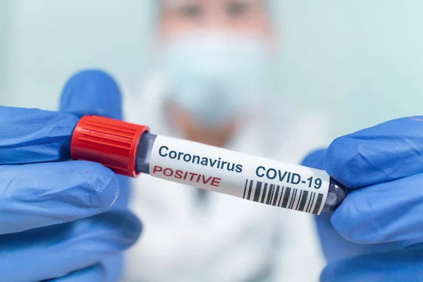 Coronavirus infected swab test