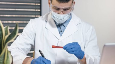 Elinde kan örneği tutan bir doktorun eli.