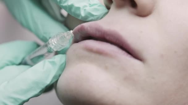 Gros Plan Des Mains Esthéticienne Faisant Injection Botox Dans Les — Video