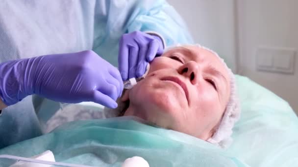 Пластическая хирургия, доктор делает укол в лицо — стоковое видео