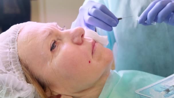 Πλαστική χειρουργική, ο γιατρός κάνει έναν πυροβολισμό στο πρόσωπο — Αρχείο Βίντεο