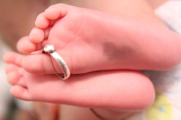 Anéis Casamento Nas Pernas Bebê Recém Nascido — Fotografia de Stock