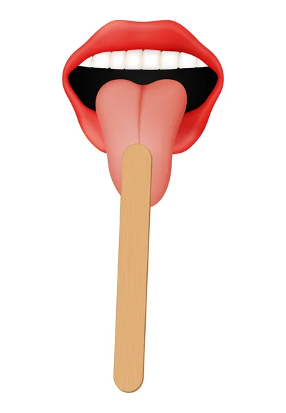 Ludzkie usta z drewnianym językiem depresor — Wektor stockowy