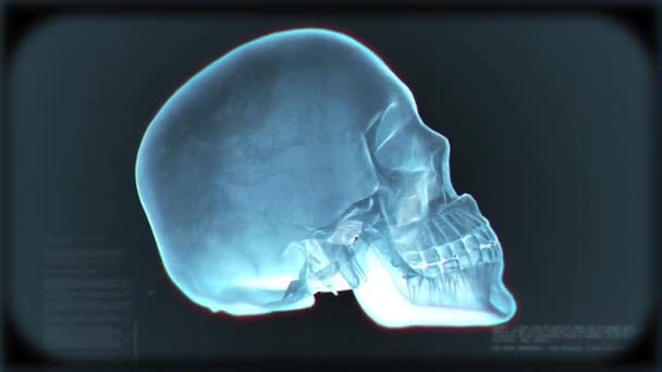 Rayos X del asa del cráneo — Vídeos de Stock