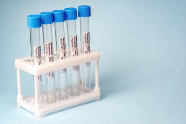 Medical test tubes for coronavirus 2019-nCoV blood tests in holder on a blue background