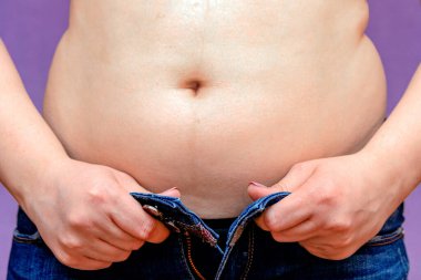 Şişman Kadın, obez, sıkı göbek, kot pantolon giyiyor.